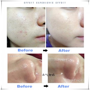 Ipartner Wasserstoff-Sauerstoffflasche 6 in 1 Multifunktions-Hautreiniger