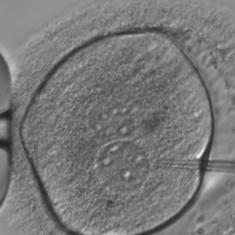 chinesische wissenschaftler behauptet, world \ ersten gene herausgegeben babys in verweigerung von krankenhaus und einen internationalen aufschrei