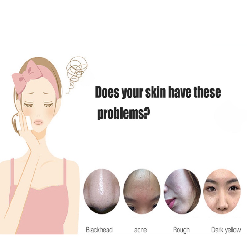 Deep Cleaning EXFOLIATOREN Hautverjüngung Gesichtslift Gesichtsbehandlung Ultraschall Hautwäscher