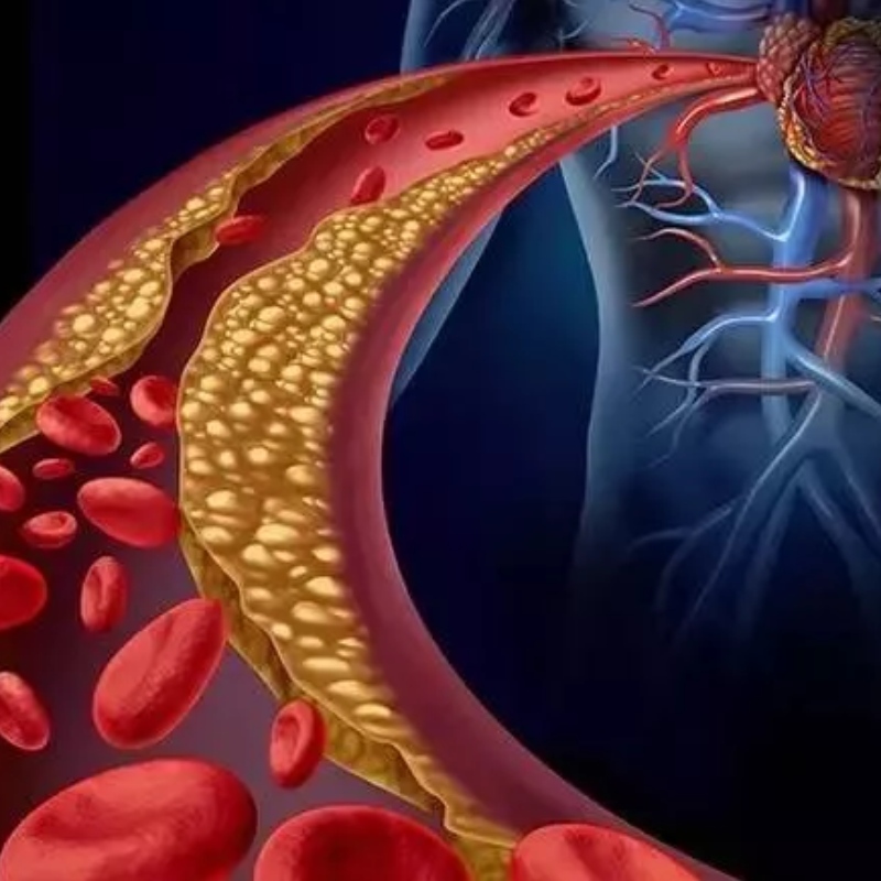 Universität von Japan: NMN hat das Potenzial, die arterielle Steifheit zu lindern